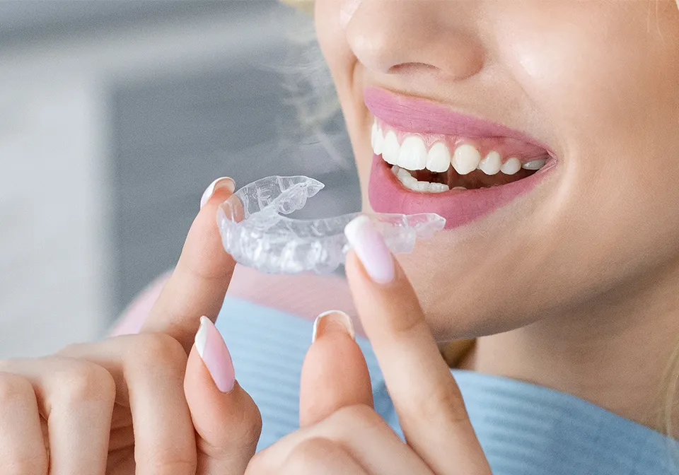 Orthodontics Braces